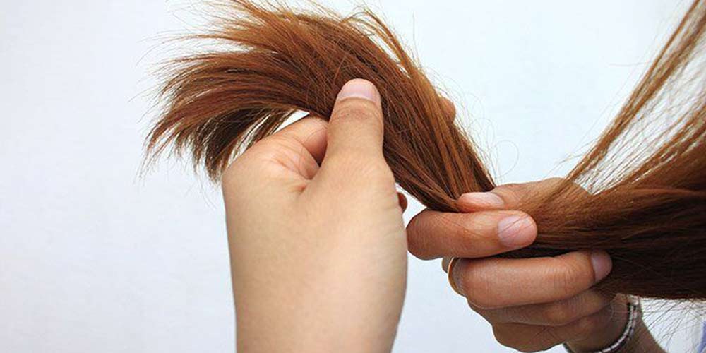 اسید تراپی مو چیست	