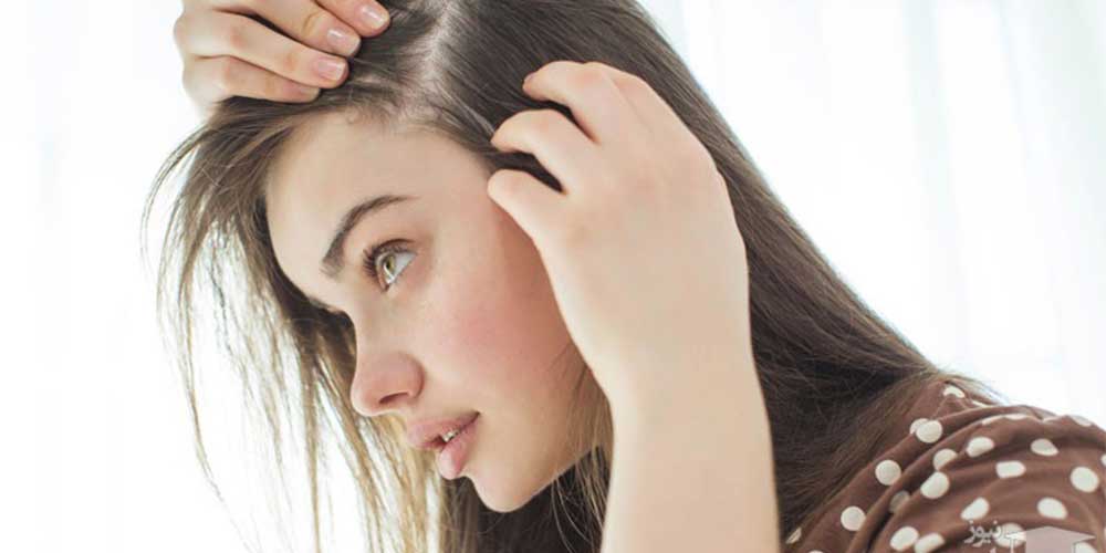 ریزش مو در زنان بعد از کرونا